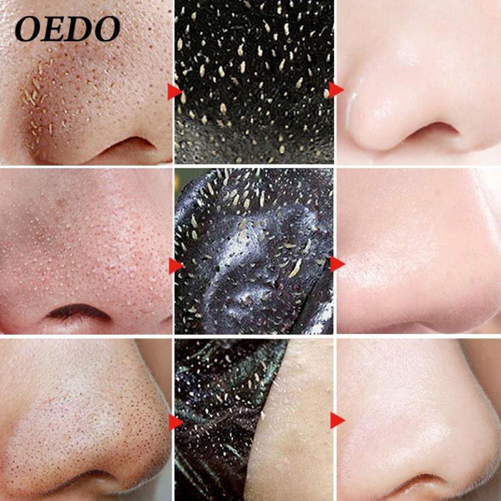 Mặt Nạ Than Tre OEDO Lột Mụn Đầu Đen Mũi Oedo030 | BigBuy360 - bigbuy360.vn