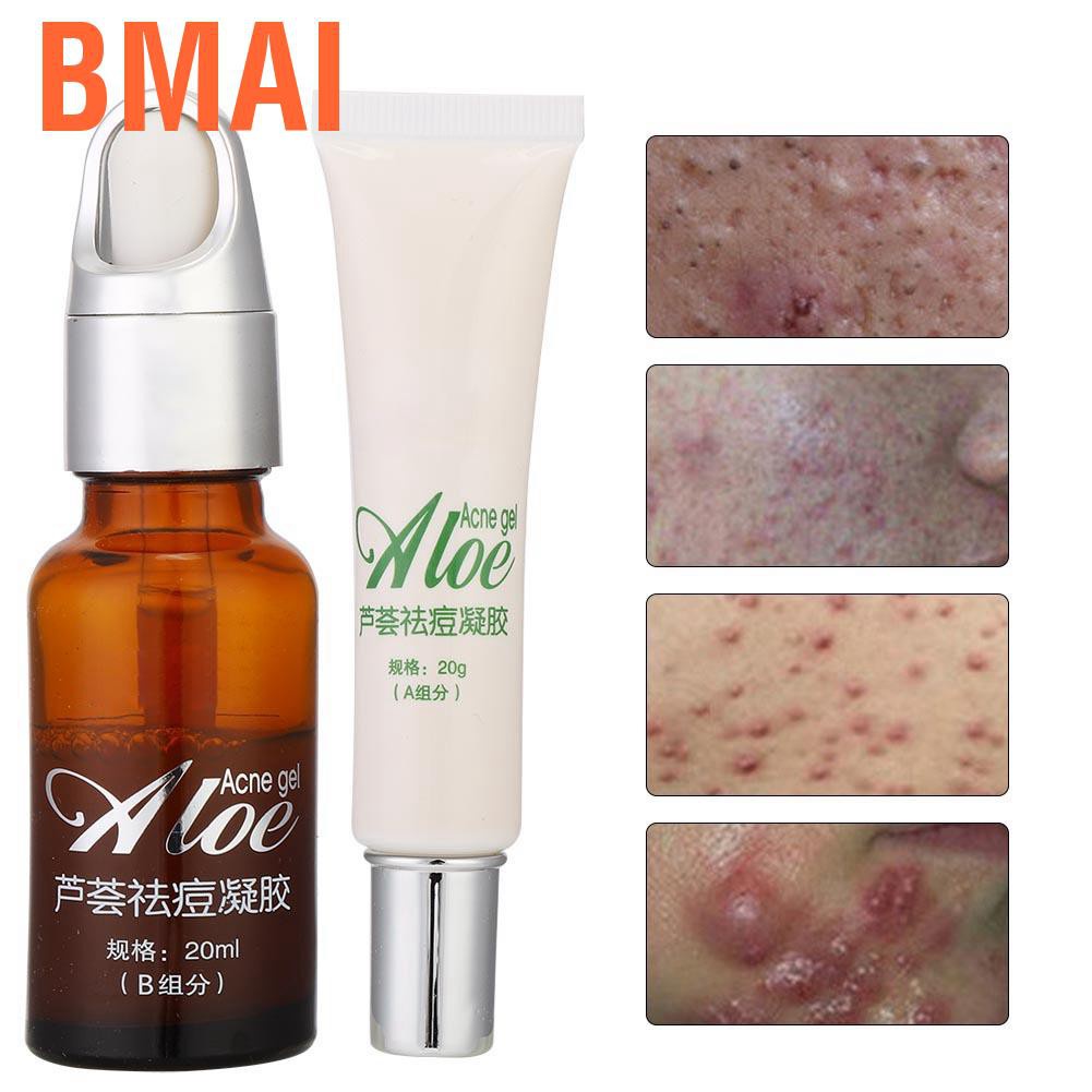 (hàng mới về) gel lô hội hỗ trợ giảm mụn chăm sóc da 20ml + b 20ml