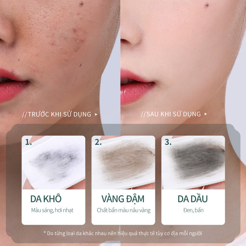 Kem tẩy da chết SOON PURE làm mịn và sáng da 50ml chất lượng cao | BigBuy360 - bigbuy360.vn