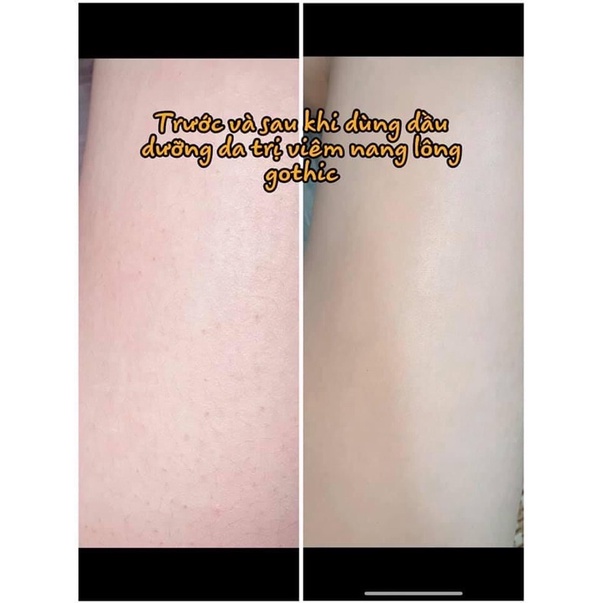 DẦU DƯỠNG DA BODY GOTHIC CHAI 150 ML (Cấp ẩm,mịn da) | BigBuy360 - bigbuy360.vn