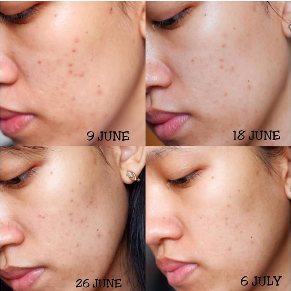 Tinh Chất Vitamin C Giúp Mờ Thâm Nám, Trắng Sáng Dành Cho Da Nhạy Cảm Klairs Freshly Juiced Vitamin Drop