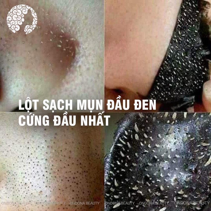 [100% THIÊN NHIÊN] GEL HÚT MỤN THAN HOẠT TÍNH TITAN CAO CẤP Gold Bee - Ondona Beauty