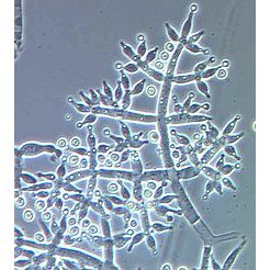 [HOT] [CHÍNH HÃNG] Nấm đối kháng Trichoderma Bacillus 2.1