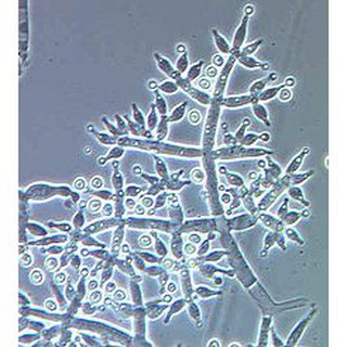 [HOT] [CHÍNH HÃNG] Nấm đối kháng Trichoderma Bacillus 2.1
