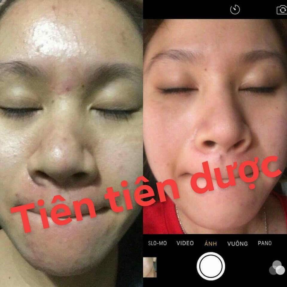 COMBO TÁI TẠO DA TIÊN TIÊN DƯỢC