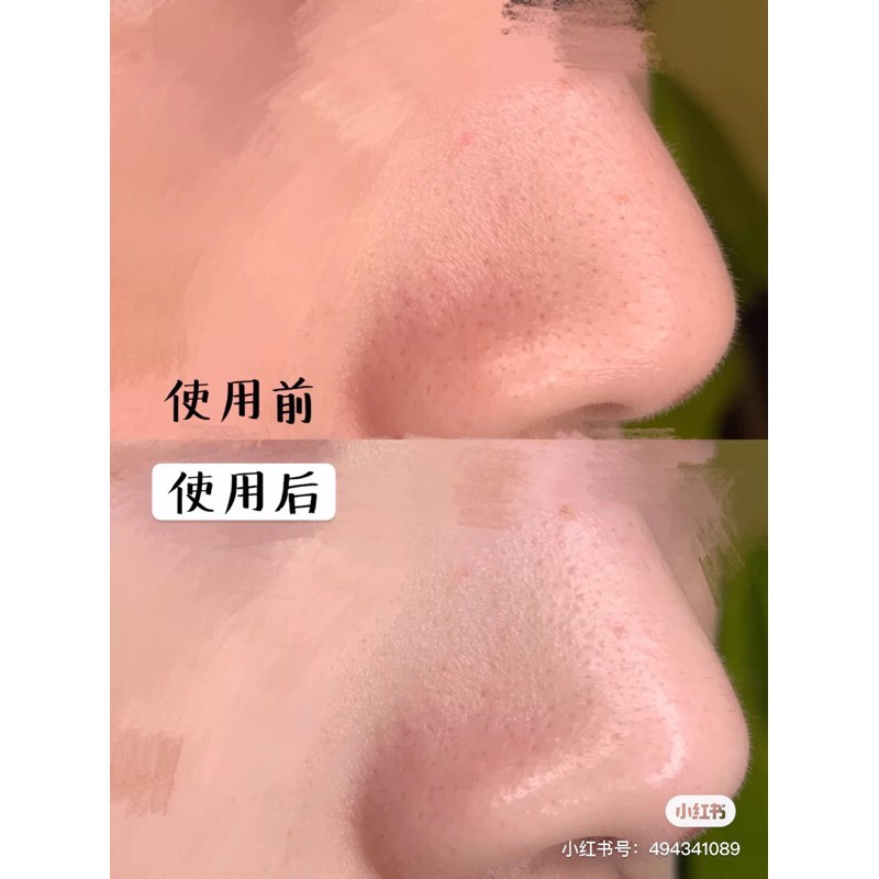 Mặt nạ Goodbye Blackhead Lẻ + que gạt mụn