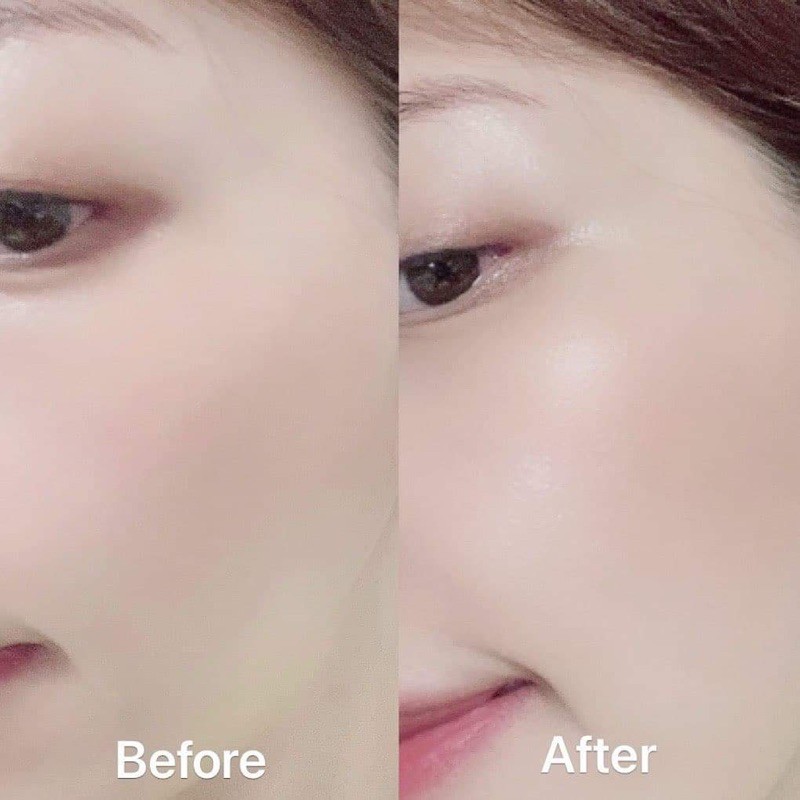 Set tế bào gốc ALLDERMA 🌼