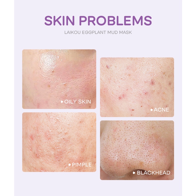 Mặt Nạ Bùn Chiết Xuất Cà Tím Laikou Loại Bỏ Mụn Đầu Đen Tẩy Tế Bào Chết Dưỡng Ẩm