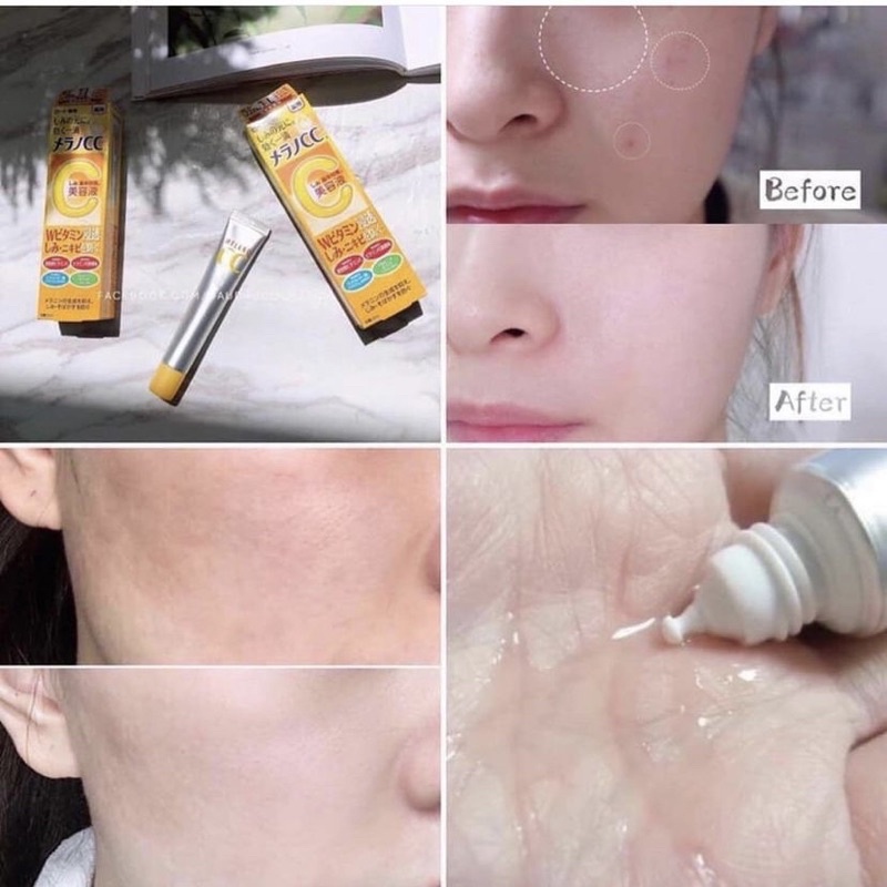 Tinh chất serum CC Melano