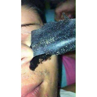 COMBO GEL lột mụn Lê Thanh