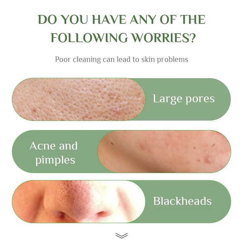 (Hàng Mới Về) Mặt Nạ Bùn Trà Xanh Kiềm Dầu Dưỡng Ẩm Loại Bỏ Mụn Đầu Đen Se Khít Lỗ Chân Lông Hiệu Quả uniq | BigBuy360 - bigbuy360.vn