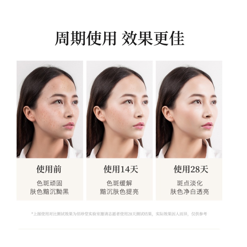 Sữa dưỡng giảm nám và chống tàn nhang thảo dược BAIZTON 80ml da trắng sáng không tì vết - Hiệu quả chỉ 28 ngày A262