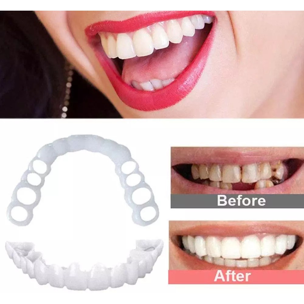 Sẵn sàng chuyển hàng Hot 2Pcs Perfect Smile Răng giả Che răng giả Răng giả Veneers Trắng răng trắng Răng chụp lại răng Chăm sóc răng giả thẩm mỹ