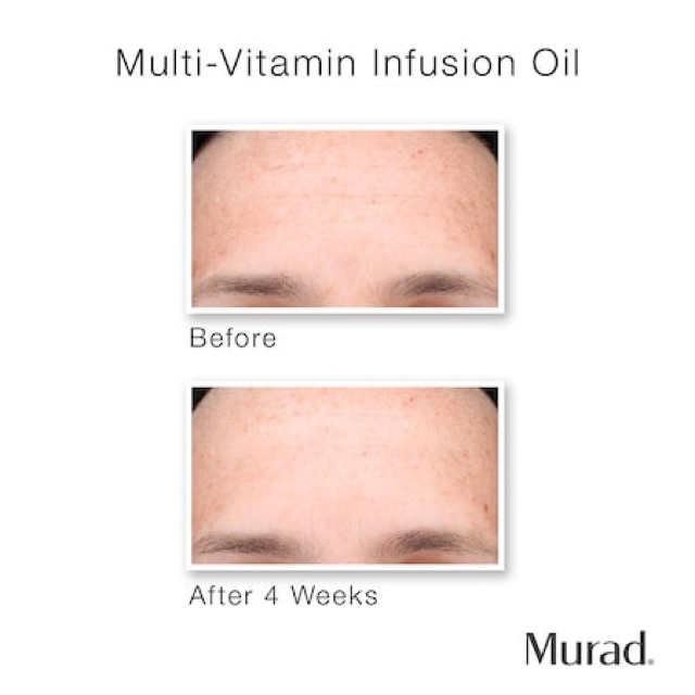 🌳Dầu dưỡng da làm sáng và chống lão hoá MURAD MULTI-VITAMIN INFUSION OIL minisize unbox | BigBuy360 - bigbuy360.vn