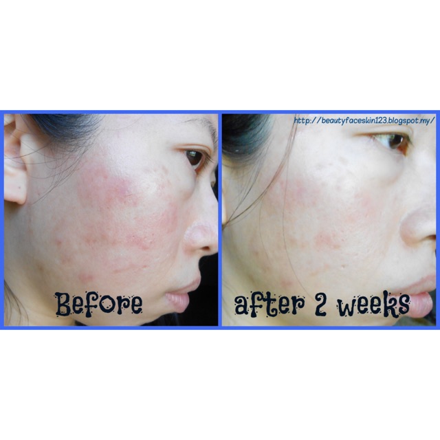 Tinh chất Klairs Freshly Juiced Vitamin Drop | BigBuy360 - bigbuy360.vn