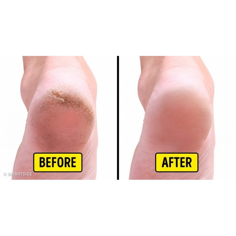 Kem dưỡng gót chân O’Keeffe’s Healthy Feet Cream