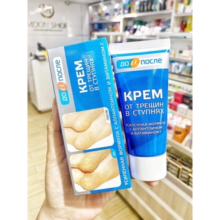 Kem giảm nứt gót chân kpem apteka 50ml nga