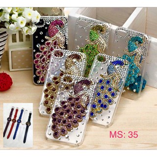 ỐP LƯNG HANDMADE MS 35