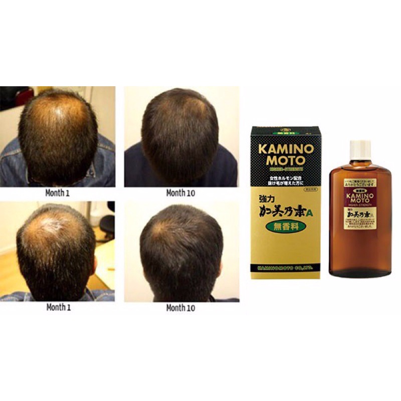 (AUTH) TINH DẦU DƯỠNG TÓC VÀ MỌC TÓC KAMINOMOTO HIGHER STRENGHT