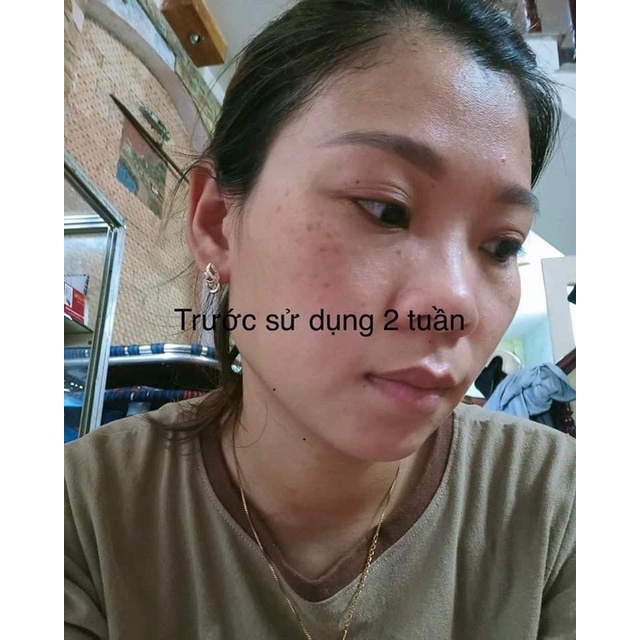 Kem xoá nám mờ thâm nám tàn nhang dưỡng trắng da DR.mh Mela Q +plus hàn