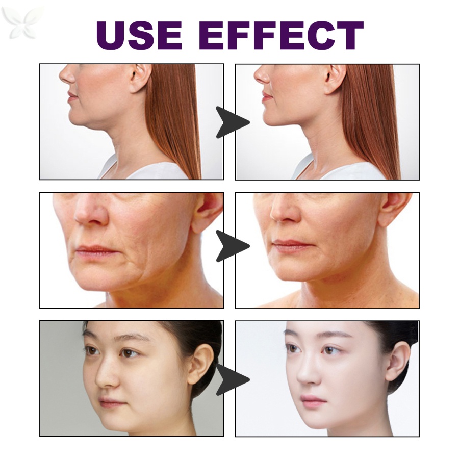 Hộp 60 Miếng Dán Làm Thon Gọn Khuôn Mặt Chữ v Vô Hình Chống Nước Thoáng Khí