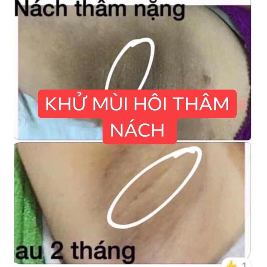Kem tri thâm nách Qnic 15g