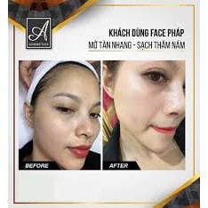 [ Giá sỉ ] kem dưỡng trắng da mặt face pháp 2020 Acosmetics