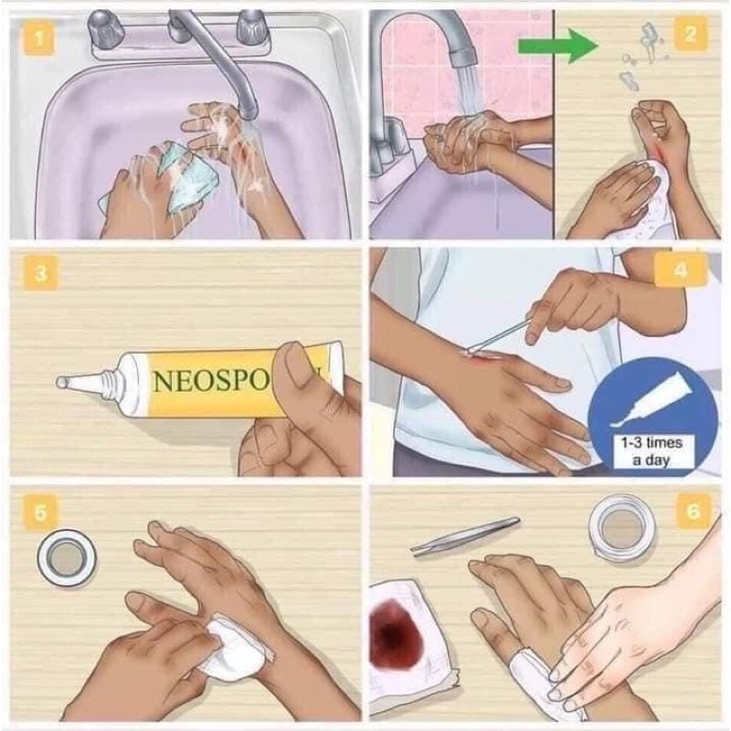 Neosporin Original Ointment – kem mỡ hỗ trợ làm lành vết thương Hộp 56.7g