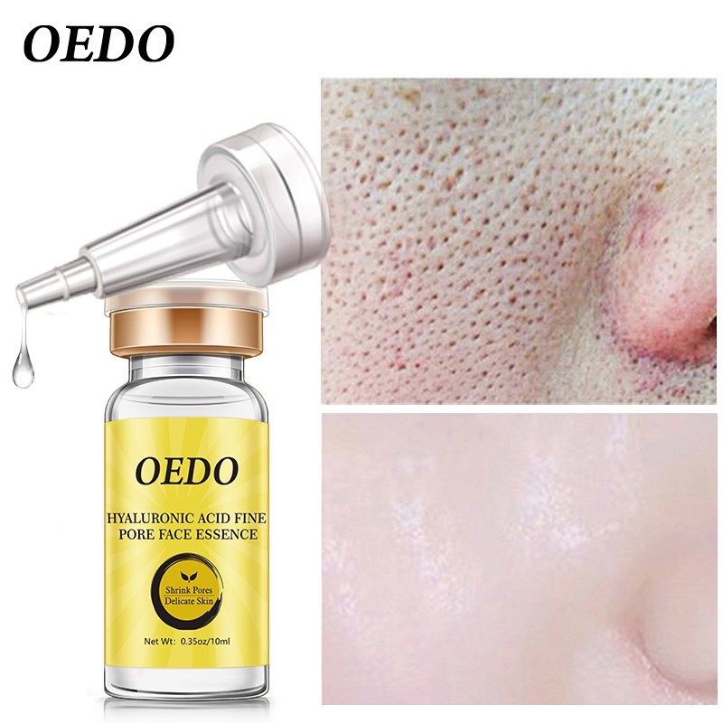 OEDO Hàng mới về Bộ 5 sản phẩm gồm sữa rửa mặt+mặt nạ lột mụn đầu đen+serum se khít lỗ chân lông+kem dưỡng da tay