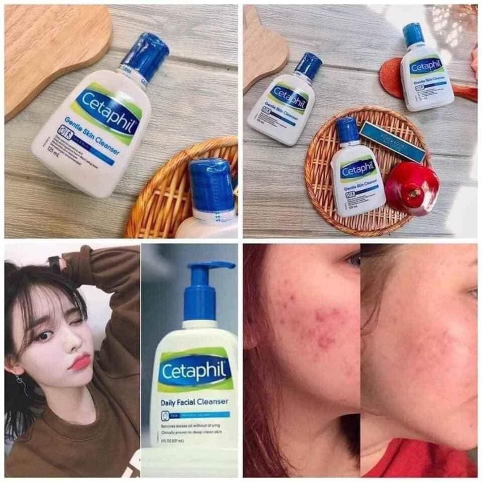 (Chuẩn úc) Sữa Rửa Mặt Cetaphi Gentle Skin Cleanser | BigBuy360 - bigbuy360.vn