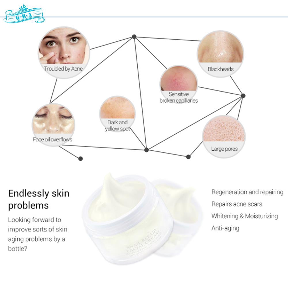 (hàng Mới Về) Tinh Chất Ốc Sên 30g Giúp Chống Lão Hóa Cao Cấp | BigBuy360 - bigbuy360.vn