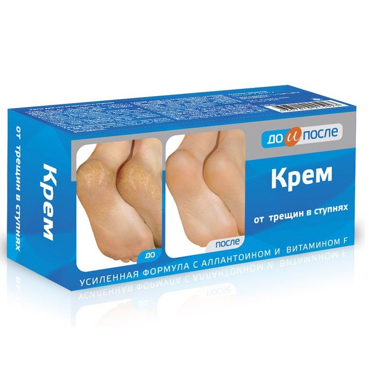 KEM NỨT GÓT CHÂN APTEKA CỦA NGA