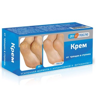Kem nứt gót chân apteka của nga