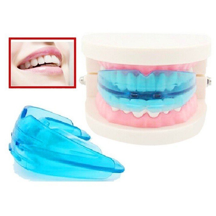 Dụng cụ niềng răng tại nhà an toàn, chất lượng