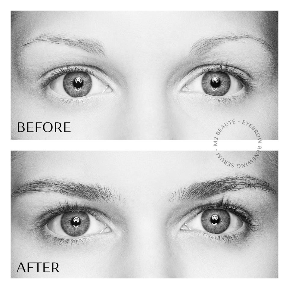 Serum mọc mày M2 Beaute Eyebrows Renewing Serum