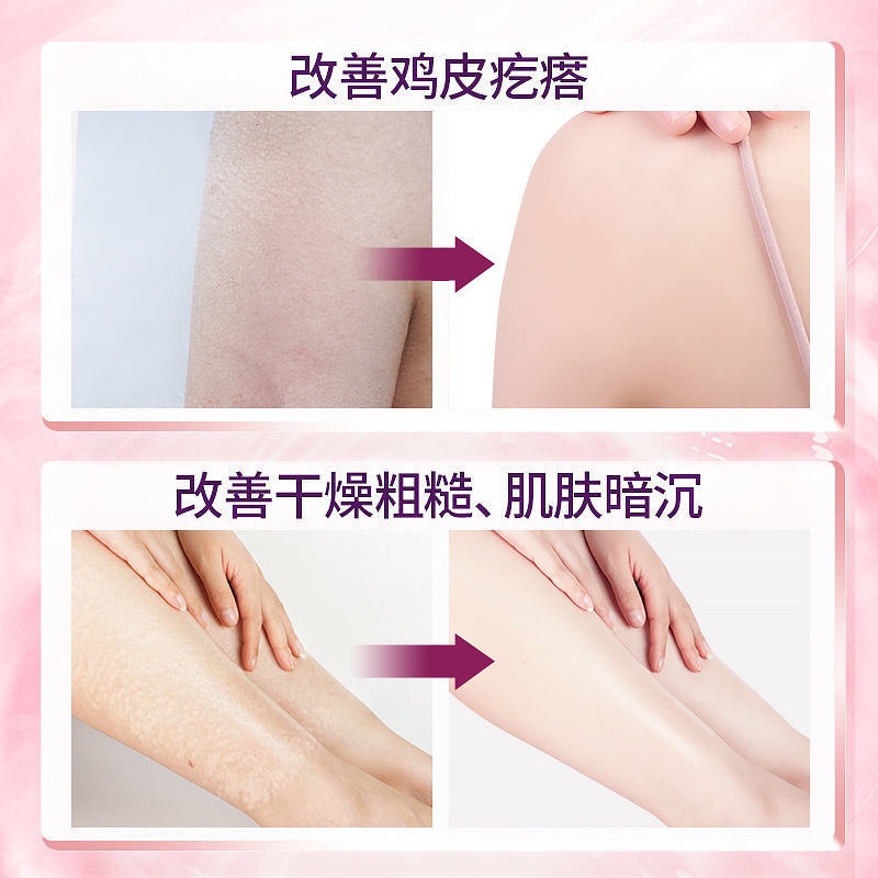 Xueling Fei Nicotinyl Press Body Lotion Whitening Moisturizing Yeast Water Milk Bộ dưỡng ẩm trẻ hóa da