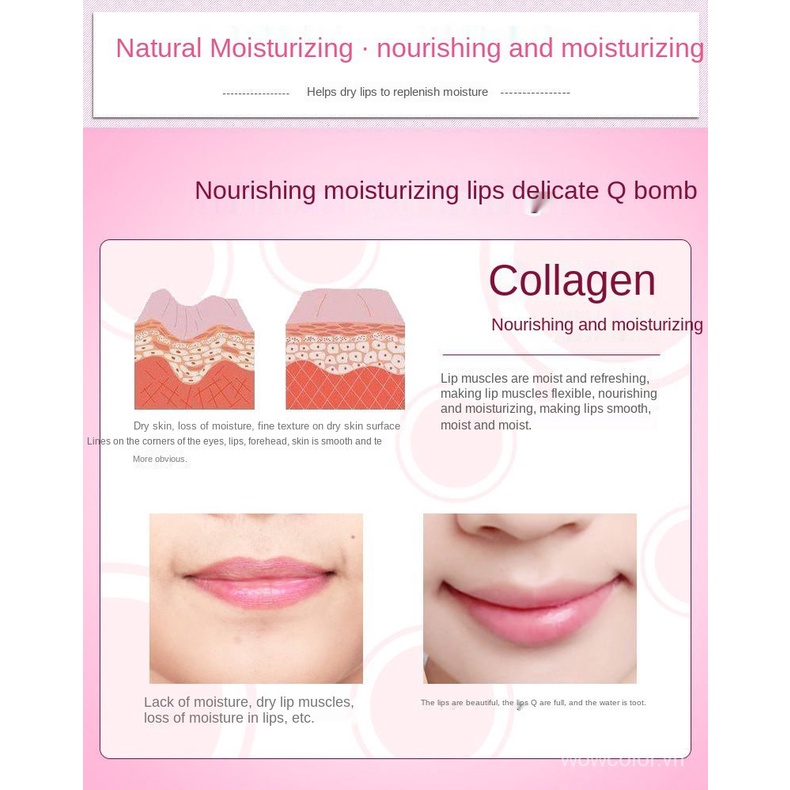 [Hàng mới về] Mặt nạ môi BIOAOUA cherry dưỡng ẩm