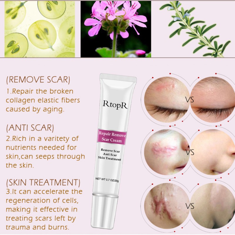 [Hàng mới về] Kem làm mờ và xóa sẹo hiệu quả tiện dụng | BigBuy360 - bigbuy360.vn