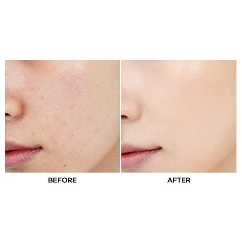 Che khuyết điểm Clio Kill Cover | BigBuy360 - bigbuy360.vn