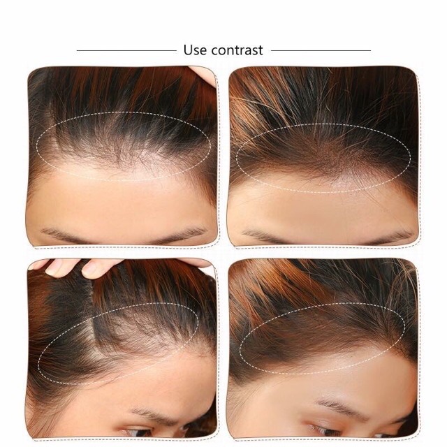 😱SẢN PHẨM CHE KHUYẾT ĐIỂM PHẦN CHÂN TÓC THẦN THÁNH😱 | BigBuy360 - bigbuy360.vn