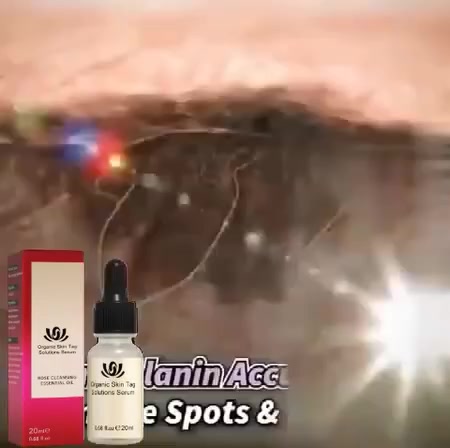 kem loại bỏ nốt ruồi mụn, loại bỏ mụn cóc ở da, tẩy nốt ruồi, nám, sắc tố đen, tàn nhang, làm sạch và phục hồi da | BigBuy360 - bigbuy360.vn