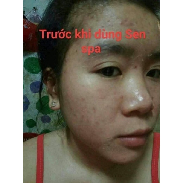 Combo Serum Thảo Dược + Bột Thảo Mộc Sen Spa Mẫu Mới