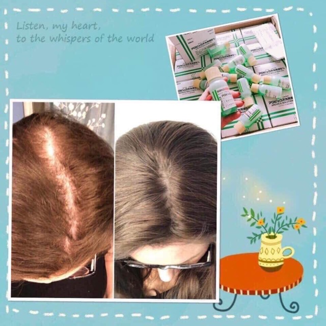 Tinh chất kích thích mọc tóc Sato Nhật Bản | BigBuy360 - bigbuy360.vn