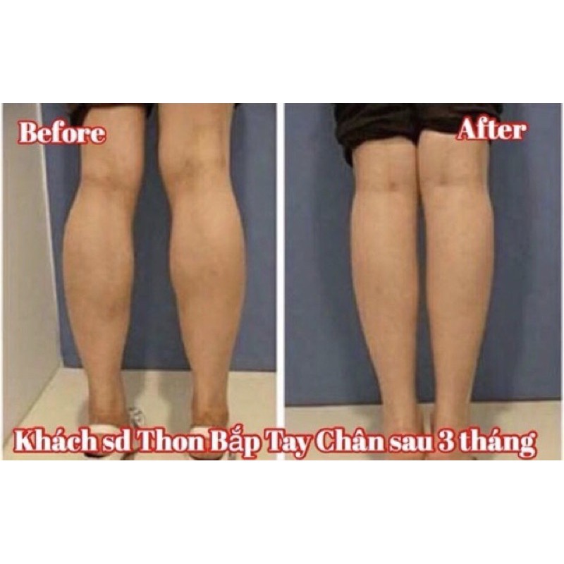 Serum tinh chất thon gọn bắp tay bắp chân - Hàn Quốc (20ml)