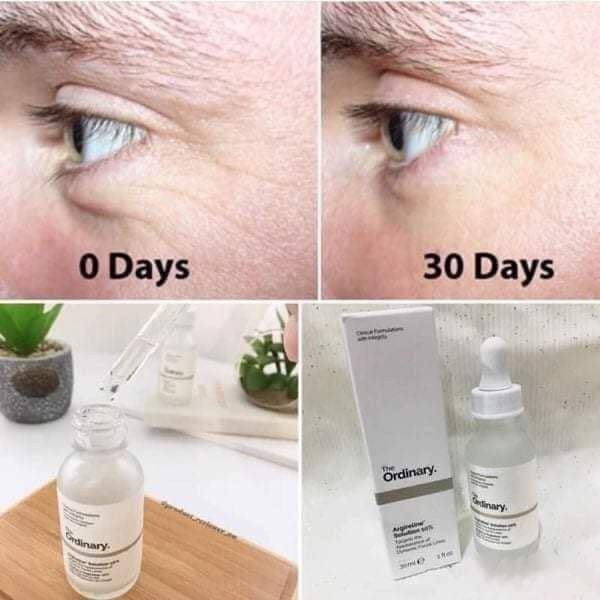 The Ordinary Argireline Solution 10% - Tinh chất ngăn ngừa nếp nhăn The Ordinary