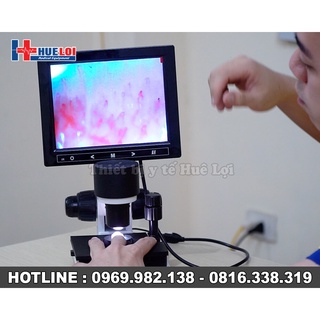 Kính hiển vi soi mạch máu