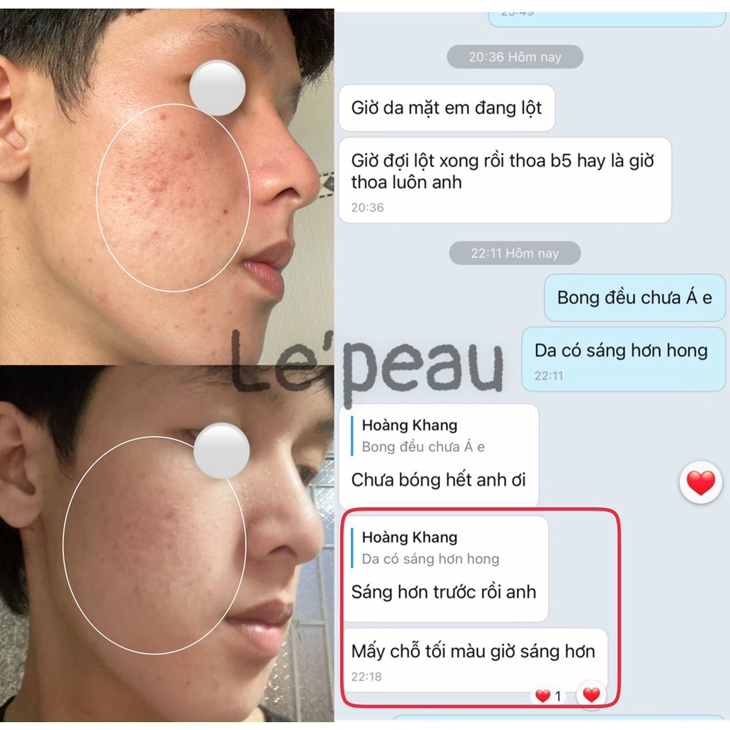 LE’PEAU - Peel da Vi Tảo Retinol chính hãng