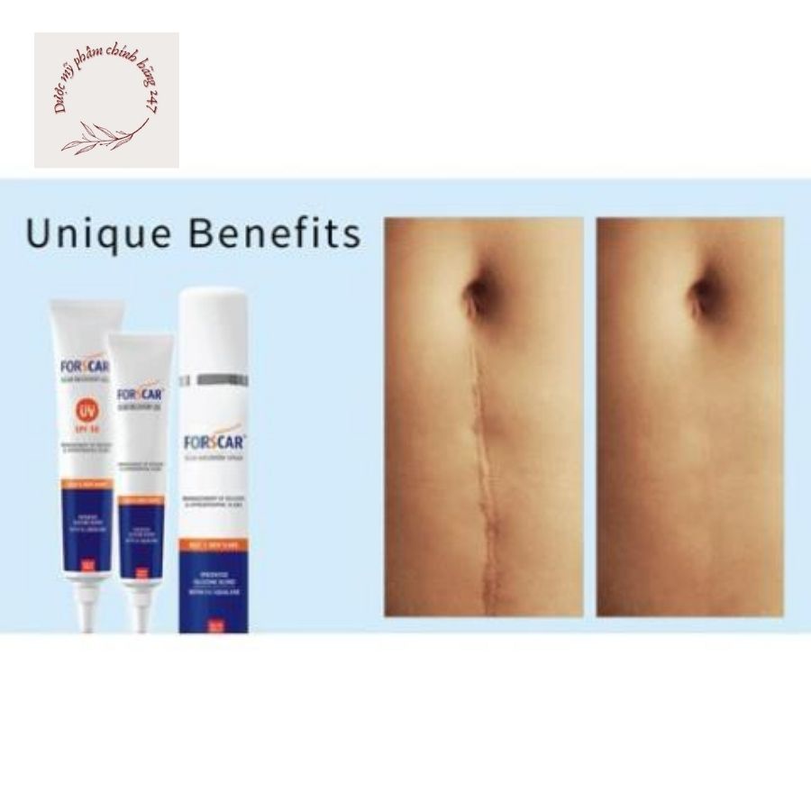 Kem mờ Sẹo Forscar - được tin dùng tại châu Âu & Mỹ