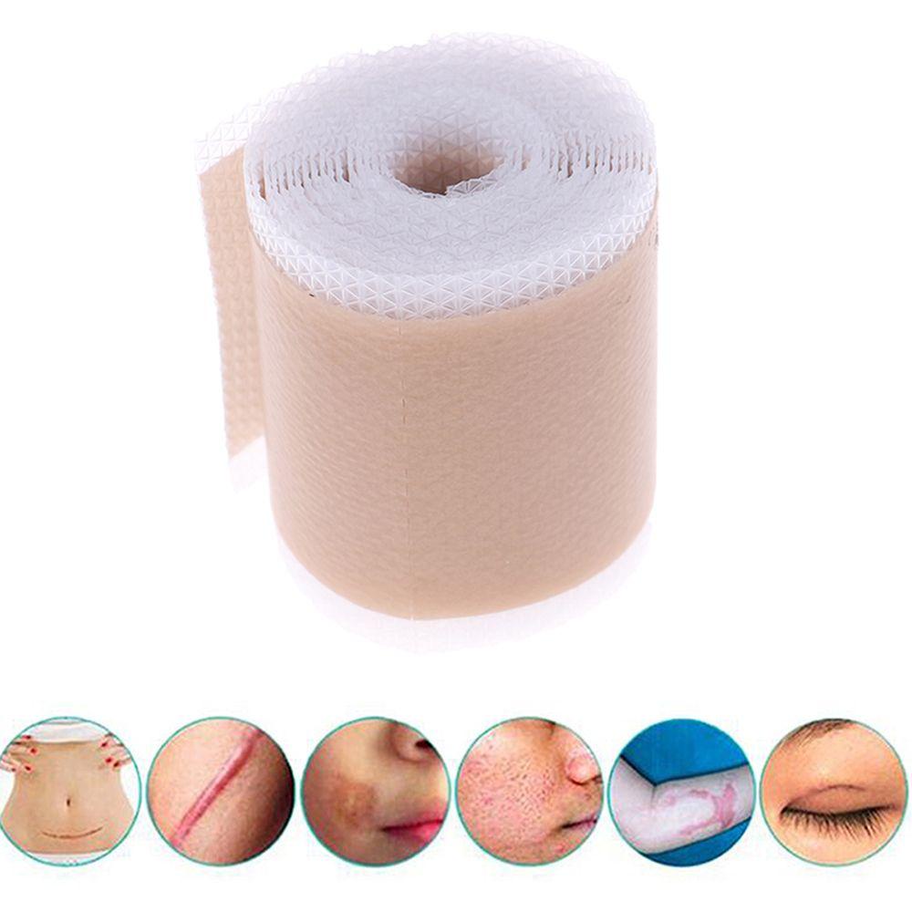 Miếng Dán Hỗ Trợ Giảm Sẹo Mụn An Toàn Hiệu Quả