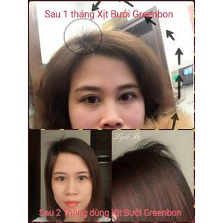 XỊT TÓC DINH DƯỠNG VỎ BƯỞI GREENBON